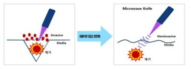 치료기술의 패러다임 변화 예시도