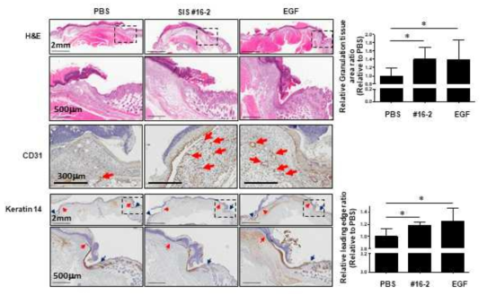 조직학적 분석을 통한 혁신형 펩타이드 SIS-1 #16-2의 피부 재생능 확인