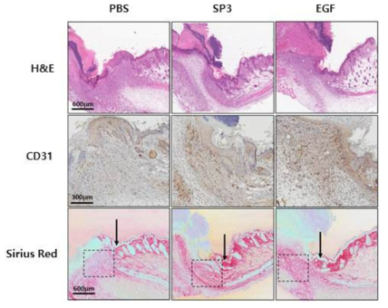 조직학적 분석을 통한 혁신형 펩타이드 SP3의 피부 재생능 확인