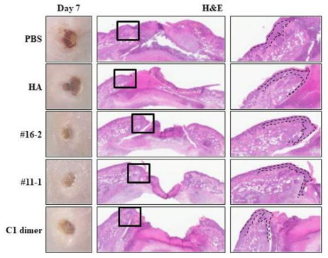 흉터 치료용 펩타이드 3종의 상처 크기 감소 및 상피세포 재생 효과