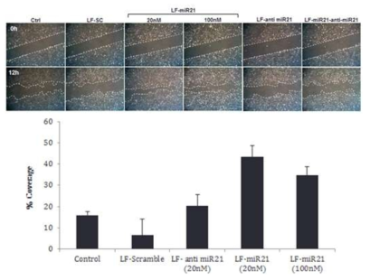 유전자 기반 융합소재 (miR21)를 처리한 human dermal fibroblast의 migration assay 이미지 및 정량 그래프