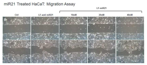 유전자 기반 융합소재 (miR21)를 처리한 human keratinocyte cell의 migration assay 이미지