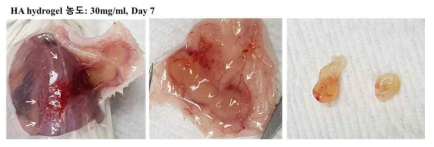 히알루론산 하이드로젤의 생체 내 주입 후 생체적합성 평가