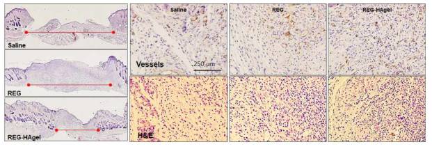 창상 조직의 H&E 염색, 모세혈관 염색을 통한 피부재생 효능 평가
