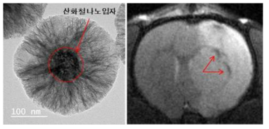 산화철 나노 입자가 중심에 도입되어 있는 이중메조기공 실리카입자의 TEM 이미지(왼쪽)와 MRI 분석(오른쪽)