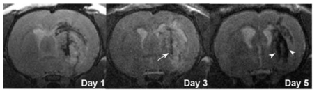 진단용 나노입자(자성 나노입자)를 이용한 MRI 조영효과를 확인한 결과