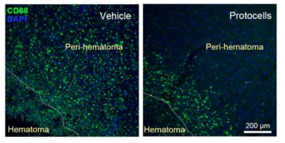뇌출혈부위에서 CD68 염증세포의 유도를 성공적으로 저해한 공초점현미경 결과