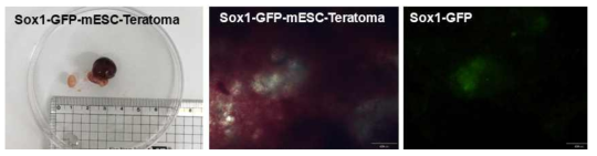 형성된지 3주차의 Sox1-GFP-mESC 유래 테라토마에서 부분적으로 Sox1-GFP를 발현 하는 것을 확인함