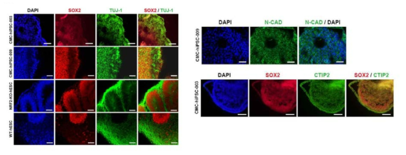 인간 유도 만능 줄기 세포 및 넉아웃 배아 줄기 세포 유래 뇌 오가노이드 형광 염색 결과. 내부에 전구 세포 마커인 SOX2를 발현하는 세포, 외부에 TUJ-1, CTIP2를 발현하는 세포로 층이 나누어짐. 또한, 신경 전구 세포 마커인 N-CAD가 신경 로젯부위에 발현하는 것을 확인함