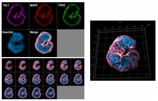 공초점 현미경을 이용해 촬영한 인간 배아 줄기 세포 유래 뇌 오가노이드. 초기 뉴런 마커인 Tuj1, 뉴런 마커인 MAP2, CTIP2를 발현하는 것을 확인함