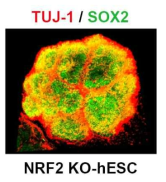 공초점 현미경을 이용해 촬영한 넉아웃 인간 배아 줄기 세포 유래 뇌 오가노이드. TUJ-1과 SOX2의 발현 패턴과 뇌 오가노이드의 전체적인 구조를 3차원 이미징화함
