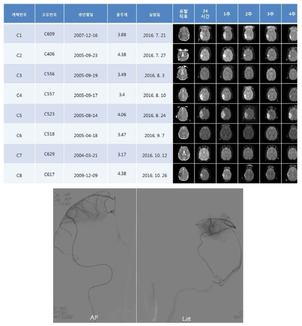 비수술적 영장류 뇌경색 모델 생산을 위한 신경중재치료 기술 및 MRI 경과 추적 결과