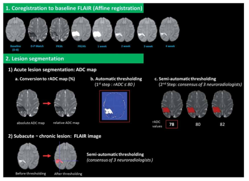 Steps of MR data processing and lesion segmentation