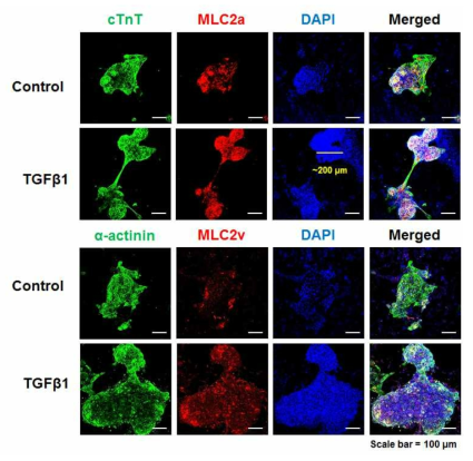 성숙인자 TGFβ1 처리 유무에 따른 심근세포 특이적 마커의 발현 변화