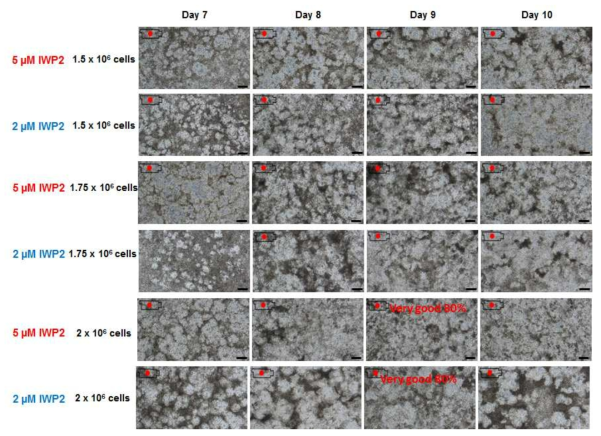IWP2 농도에 따른 심근세포 분화율 비교