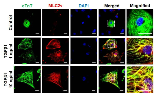 성숙인자 TGFβ1 처리에 의한 MLC2v의 발현 양상 분석