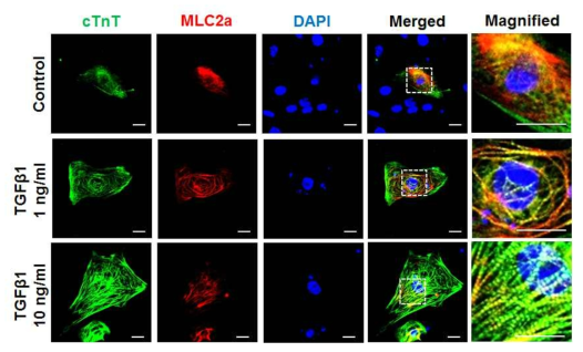 성숙인자 TGFβ1 처리에 의한 MLC2a의 발현 양상 분석