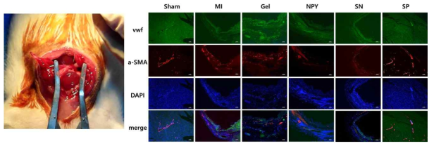 Neurogenic 펩타이드가 포합된 수화젤을 만성심근경색 모델에 주입하였을 때의 혈관형성능 비교