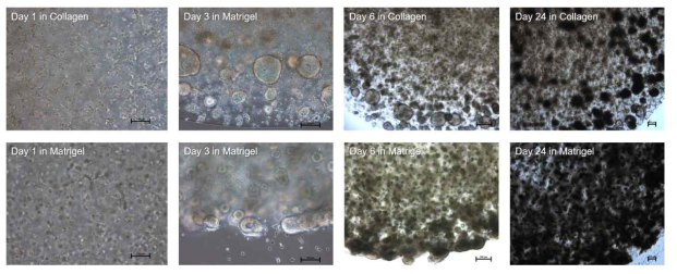 3차원 하이드로젤 안에서 배양한 BG01 세포 배양 모습