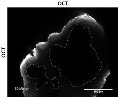 자가조립된 심근패치의 OCT 분석 이미지