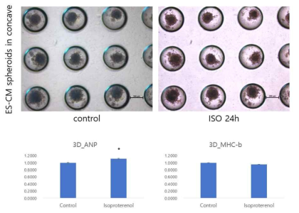 이소프로테레놀 처리 후 3차원으로 배양한 심근세포 및 심근비대증 유전자 마커 확인