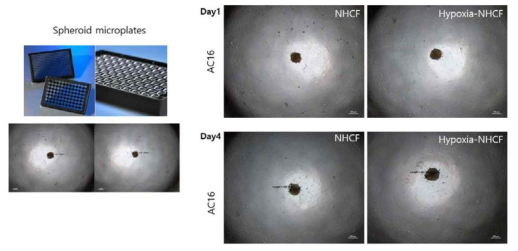 마이크로 플레이트를 사용한 스페로이드 배양 및 크기 비교