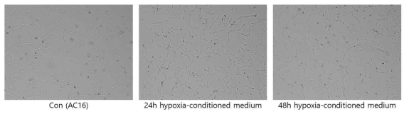 마이크로 칩 안에서 저산소증 유도 배지(24h, 48h)로 배양한 AC16 모습