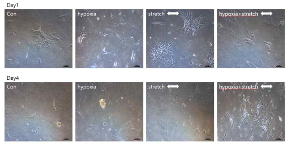 산소증 및 반복적인 인장환경에 노출된 심근섬유아세포