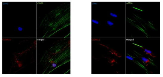 siRNA-CLDN11 처리 후 대주군에 대하여 siRNA-CLDN11 처리군의 CLDN11은 주로 핵 주위로 응집하는 현상을 보였음