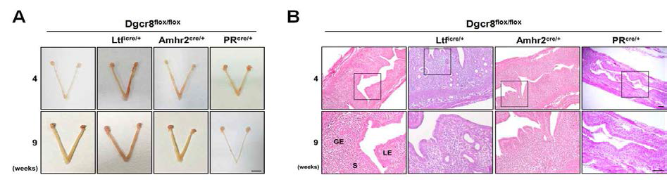 Dgcr8 cKO 생쥐의 자궁의 형태학 및 조직학적 관찰 (A) 4주령과 9주령의 자궁 세포 특이적 Dgcr8 cKO 생쥐들의 생식기관에 대한 전체적인 형태학 사진. 자궁 성숙 전 시기인 4주령에는 자궁 세포 특이적 Dgcr8 cKO 생쥐들에서 자궁에서 차이를 보이지 않고 대조군과 비슷한 형태를 보임. 성 성숙이 끝난 9주령에는 Dgcr8flox/flox;Ltficre/+ 생쥐 자궁은 대조군과 비슷한 형태를 보였지만, Dgcr8flox/flox;Amhr2cre/+ 생쥐 자궁은 길이가 짧아진 형태학적 이상이 관찰 됨. (B) 자궁 세포 특이적 Dgcr8 cKO 생쥐들의 자궁을 HLtficre/+와 Dgcr8flox/flox;Amhr2cre/+ 생쥐 자궁 조직을 관찰 하였을 때 대조군인 Dgcr8flox/flox와 유사한 자궁 형태를 보여, 대조군과 조직학적 차이점이 보이지 않음