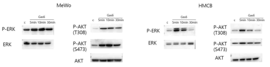 흑색종 세포에서 Gas6 처리시 하위 신호체계의 발현