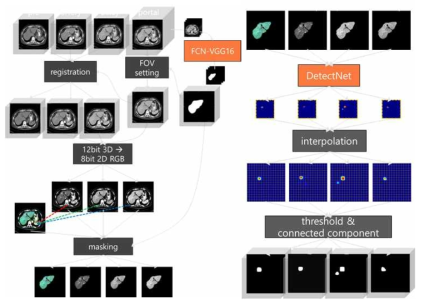 개발된 간 영역 분할 기법을 이용하여 multi-phase CT 영상을 준비하는 과정 (왼쪽)과 DetectNet을 이용하여 간암 영역을 검출하는 과정 (오른쪽)