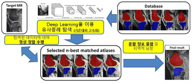 본 연구의 개요도 : 환자가 병원에서 CT 또는 MR 영상을 촬영하게 되면, 딥러닝 알고리즘을 이용하여 유사한 영상을 데이터베이스에서 탐색하게 되고, 얻어진 유사 영상들과 분할결과들을 영상정합을 통해 촬영된 영상에 맞추어보아 분할 결과를 얻는 구조