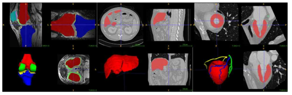 구축된 다양한 영상데이터베이스의 예 (왼쪽: 무릎 MR, 중간: 간 CT, 오른쪽, 심장 CT)