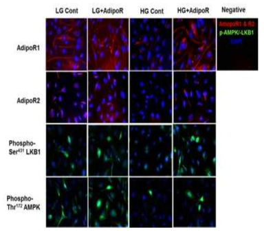 실험을 통해 calcimimetic인 cinacalcet이 제2형 db/db 마우스에서 당뇨병성 말초신경병증에서의 intracellular Ca++ 농도 증가에 따른 CaMKKβ 활성화와 LKB1 인산화가 각각 AMPK를 활성화하고, 이와 관련된 하위 신호전달계인 eNOS 인산화가 말초신경의 Schwann cell에서의 산화스트레스와 세포사멸을 억제하여 말초신경 보호효과를 가져옴을 제시함. 또한 Schwann 세포배양실험에서 저농도(5 mMD-glucose)과 고농도(15 mM)당에서 cinacalcet(15nM)의 보호효과로, 고농도당에서 감소된 CaSR, CaMKK와 LKB1과 AMPK-인산화가 cinacalcet 투여로 증가됨. 이 같은 변화는 저농도당에서는 관찰되지 않음