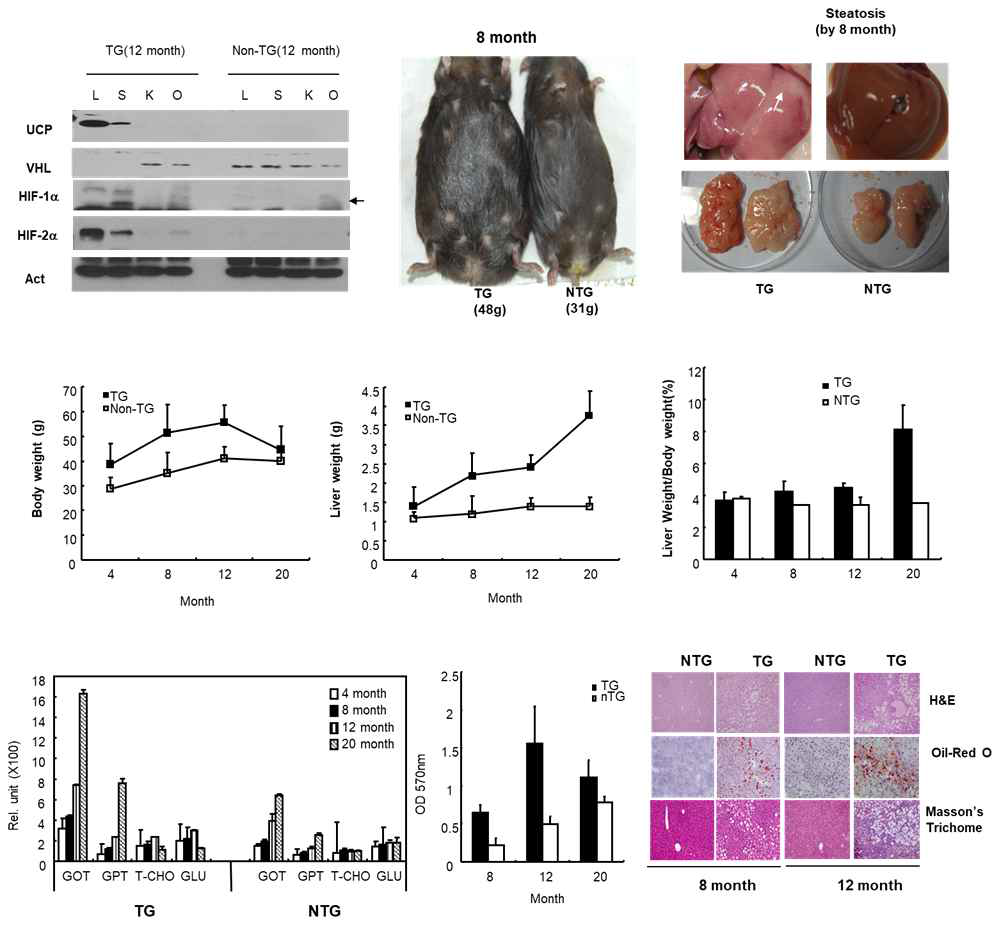 UCP-TG에서 나나타는 지방간/지방간염 표현형