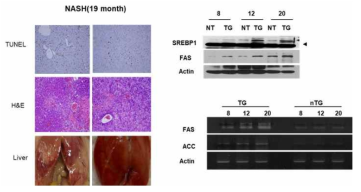 UCP-TG에서 나타나는 지방간/지방간염 조직과 SREBP-1c의 발현