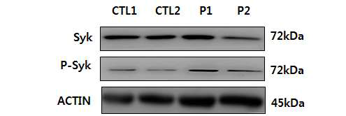 Comparision of Syk phosphorylaion from normal group and dementia patient group. The intensity of Syk phosphorylation was measured using a western blot assay. Data are expressed as means ± SD (n = 2). CTL; control group, P; dementia patient group
