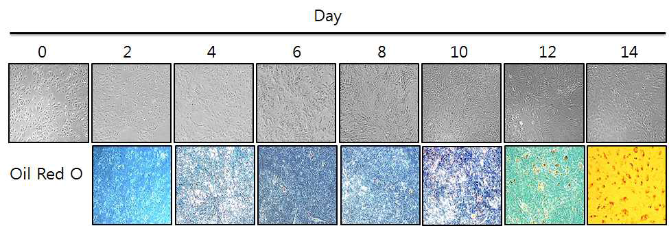 배양 일에 따른 인간유래마이봄샘상피세포주의 변화 및 lipid 생성 여부 확인