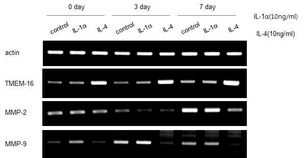 IL-4 처리 전후 ANO1(TMEM-16)과 MMP 발현의 변화