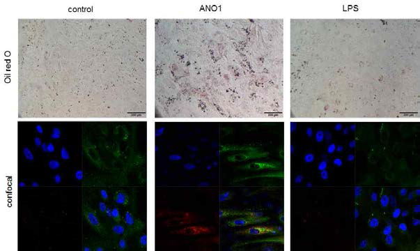 지질생성을 LipidTox, Oil-red-O(neutral lipid staining)로 확인함