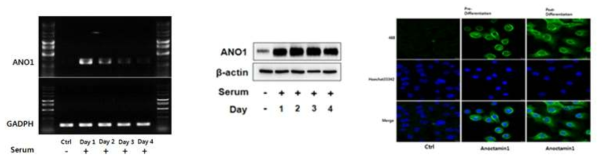 마이봄샘기능이상 토끼 모델의 안검에서 ANO1 mRNA 발현과 단백질 발현을 확인. 조직검사 및 배양된 세포에서 실시한 면역염색상에서도 분열 전후 유의한 정도의 ANO1의 발현을 확인 할 수 있음