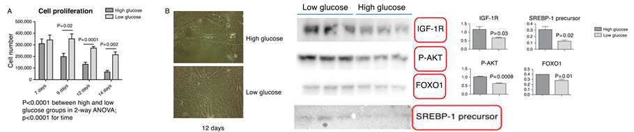고혈당 자극은 인간유래마이봄샘상피세포의 비정상적인 형태변화와 세포감소를 유도함. 고혈당 자극은 인간유래마이봄샘상피세포에서 insulin-like growth factor–1 (IGF-1), phospho (p)-AKT, Foxhead box protein O1 (FOXO1), SREBP-1 의 발현을 유의하게 감소시킴으로서 정상적인 증식과 lipogenesis에 영향을 끼침