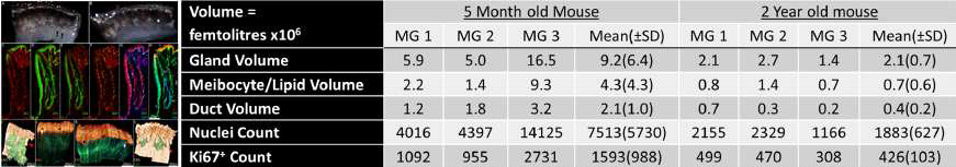 2년 연령의 노령 마우스가 5 달 연령의 마우스에 비해 마이봄샘, 지질, duct 부피가 유의하게 작았으며, 증식과 관련된 Ki67의 수가 유의하게 작음
