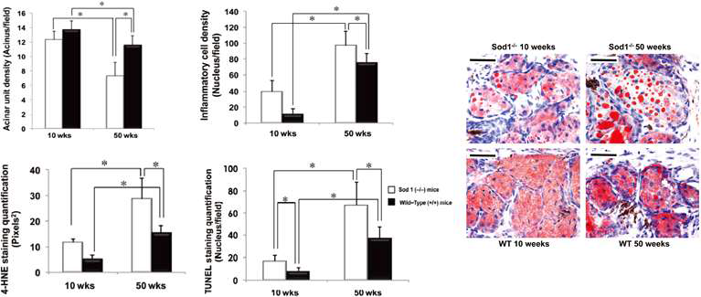 Sod1-/- 마우스는 정상마우스에 비해 눈물 생성이 적고, 안구표면이 불안정함. Acinar duct 수가 적으며, 염증세포의 침윤이 많고, 기름 droplet이 매우 크며 4-hydroxynonenal (4-HNE) 가 감소되어 있고 apoptosis marker 인 TUNEL 의 발현이 증가되어 있음