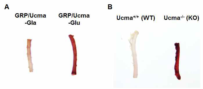 GRP/Ucma에 의한 혈관조직 석회화 저해효과 확인 (A) GRP/Ucma 단백질이 함유된 배양액에서 유도한 석회화에서 혈관 석회화의 감소 (B) Ucma 유전자 결여된 마우스의 혈관조직에서의 증가한 혈관 석회화