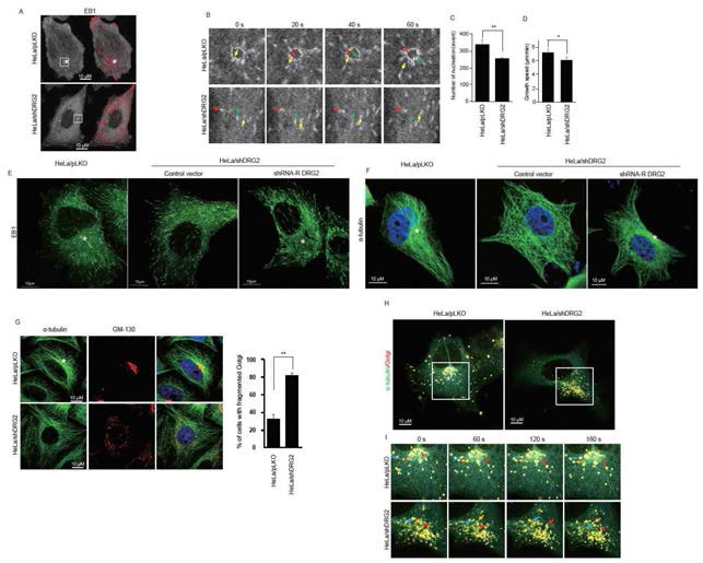 Perinuclear MTOC formation and microtubule dynamics are inhibited in DRG2-knockdown cells. (A) Representative