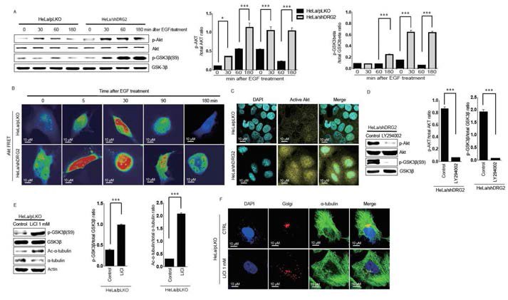 DRG2 knockdown increases Akt activity and inhibitory phosphorylation of GSK3β. (A) Time course measurement of Akt and GSK3β phosphorylation in control and DRG2-knockdown HeLa cells after EGF treatment. (B) FRET analysis of Akt activity. (C) Immunohistochemical staining for active Akt. (D) PI3K inhibitor reduces phosphorylation of Akt and GSK3β in DRG2-knockdown cells. (E) Expression levels of phosphorylated GSK3β, total GSK3β, total tubulin and acetylated tubulin. (F) Cells were fixed and stained with anti-α‐tubulin antibody