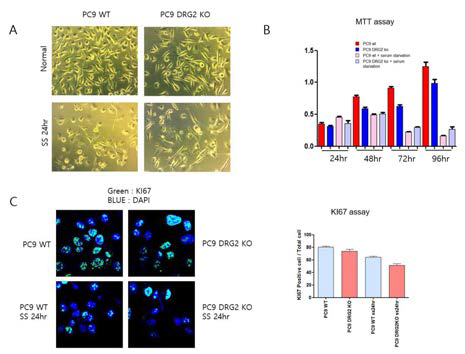 DRG2 knockdown decreases cell growth. (A) Microscopic image of control and DRG2-knockdown PC9 cells. (B) MTT assay. (C) Ki67 staining