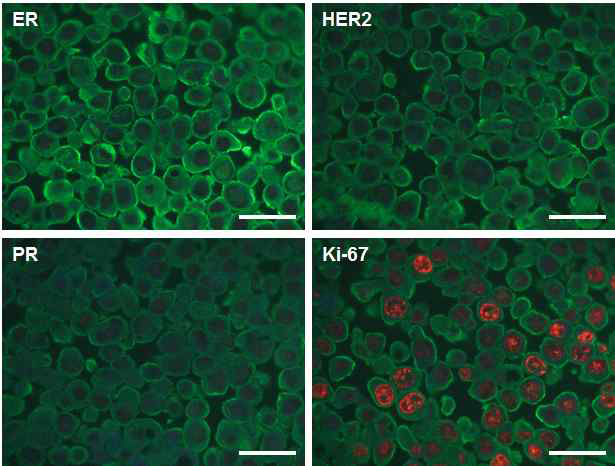 2D 환경에서 배양된 유방암 세포주 HCC70에서 형광 표지자를 이용해 바이오마커 발현 특성 평가를 수행한 사진. 네 가지 유방암 주요 바이오마커인 ER, HER2, PR, Ki67를 붉은 형광 양자점을 이용하여 발현 특성을 분석하였음